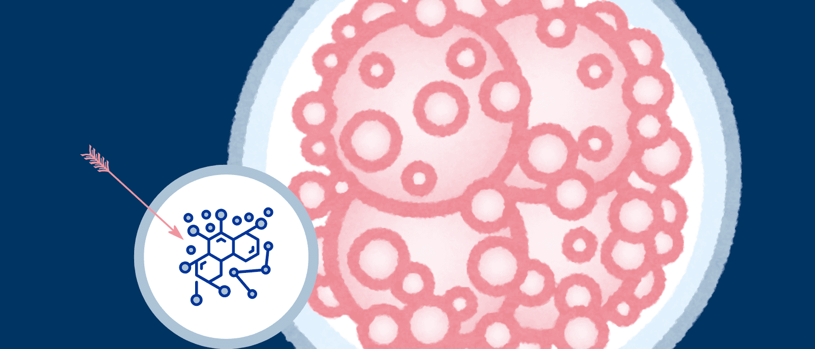 Targeting prostate cancer’s Achilles’ heel